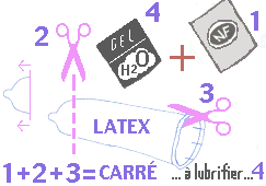 schema digue dentaire